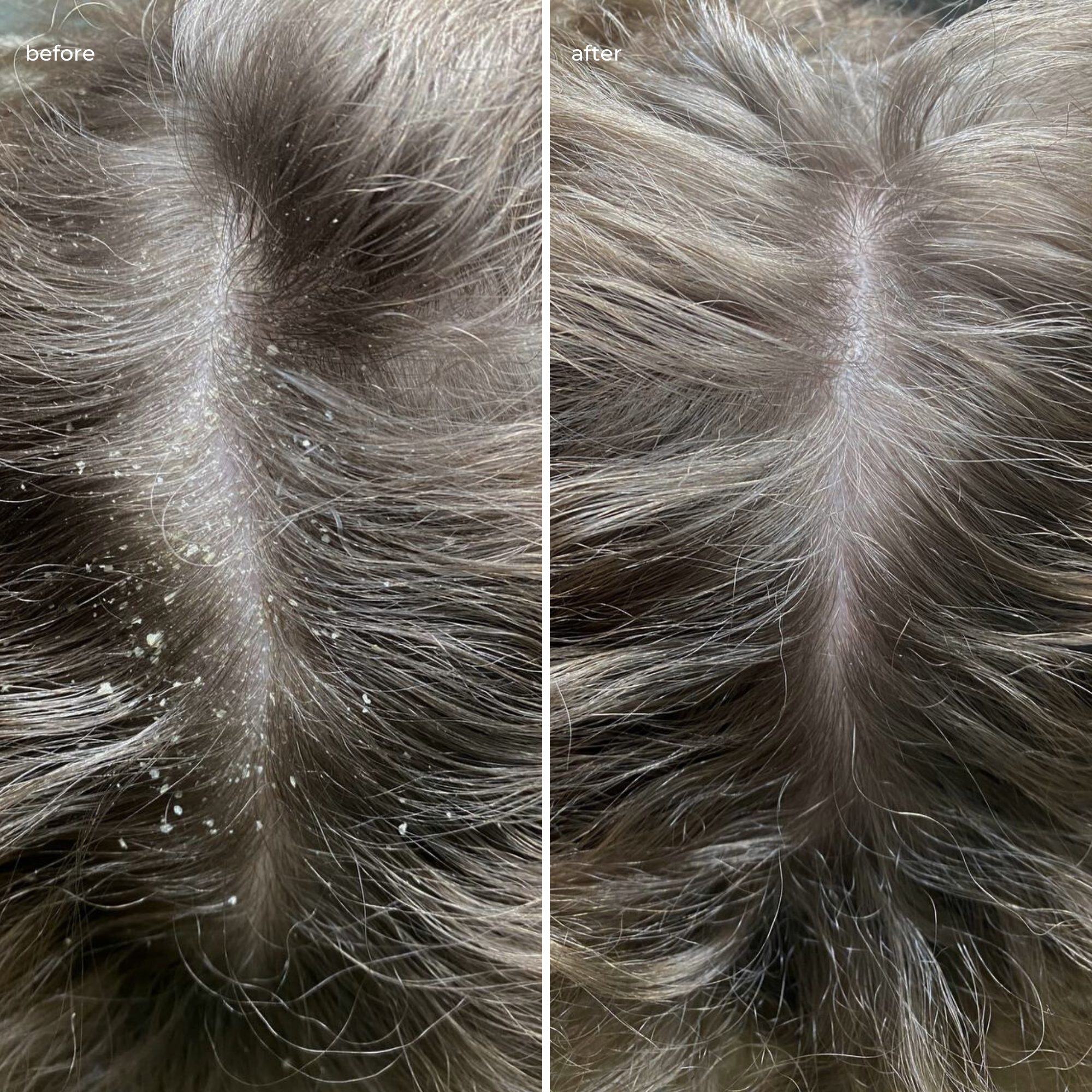 До використання догляду – свербіж, подразнення, лупа; результат після – чиста, заспокоєна шкіра голови без лупи та сухості.