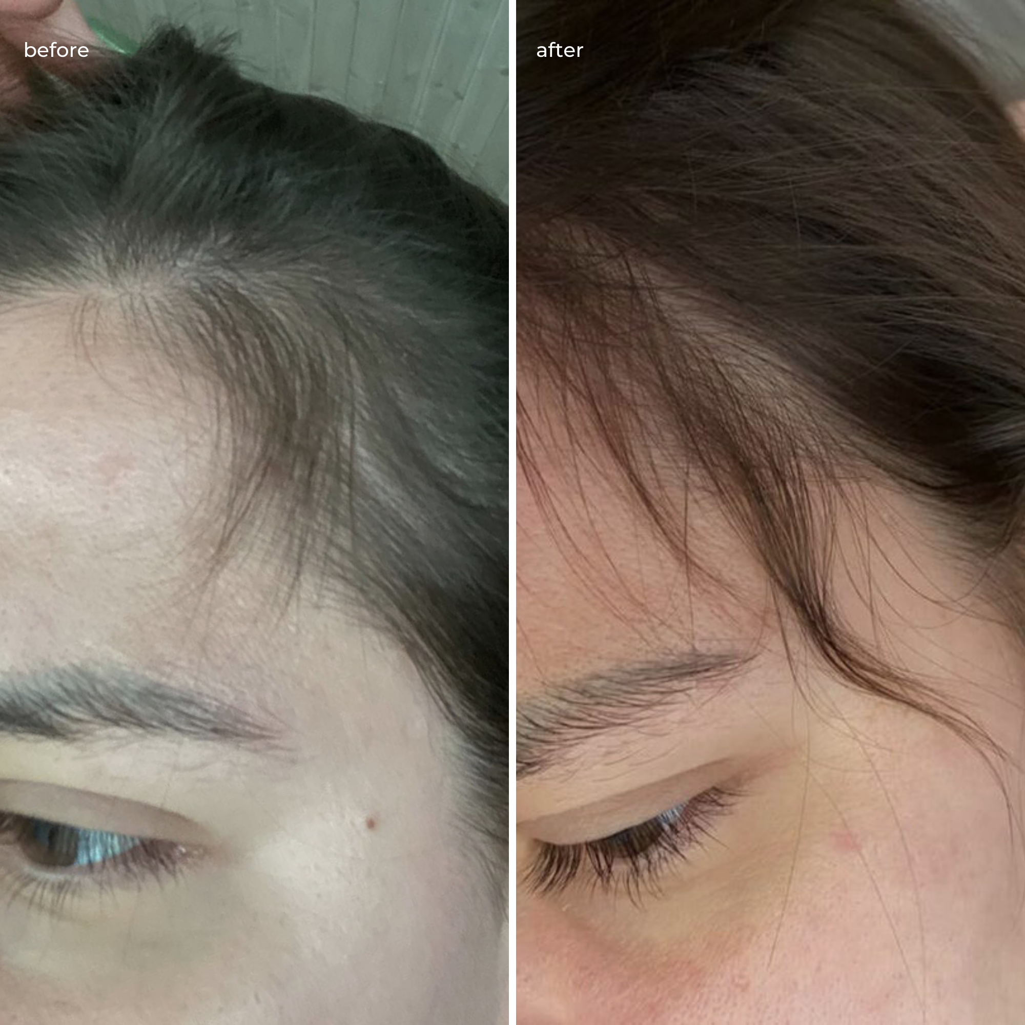 Волосся до використання серії проти випадіння – ослаблене, тьмяне, з помітним випадінням; після – більш густе, об’ємне, зміцнене.